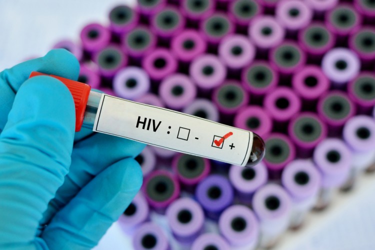 Countries With The Highest HIV Rates in Europe